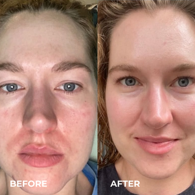 Mayuri Lab Collagen Glow Up Mask