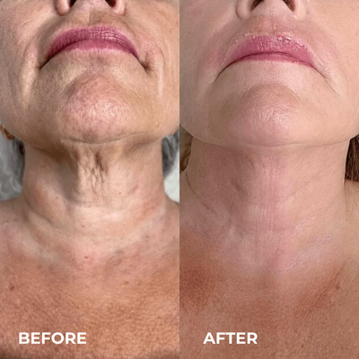 Mayuri Lab NAD+ EGF Firming Serum
