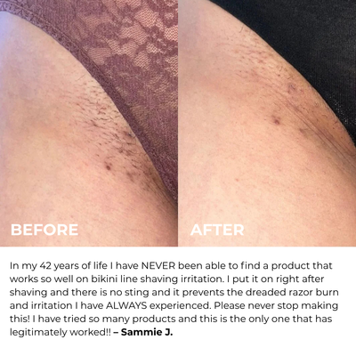 Mayuri Lab Ingrown Hair Smoothing Roller